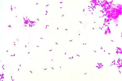 Zaadplanten, bloeiwijze