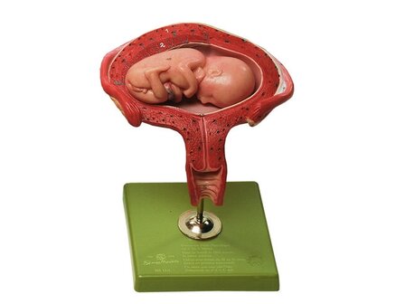 Baarmoeder met foetus, maand 4