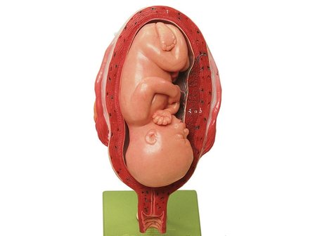 Baarmoeder met foetus, maand 7