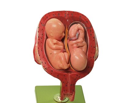 Baarmoeder tweeling, maand 5
