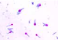 Clostridium tetani, tetanusverwekker