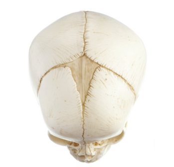 Schedel pasgeborene QS 3/E