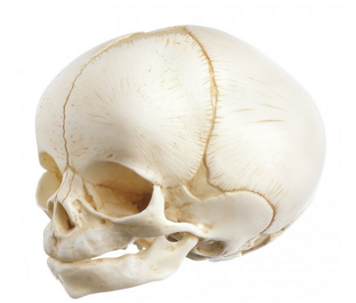 Schedel pasgeborene QS 3/E
